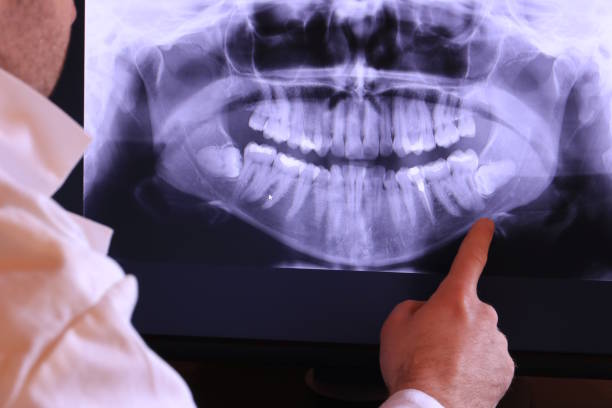 Best Emergency Dental Care for Abscessed Tooth in Searles Valley, CA