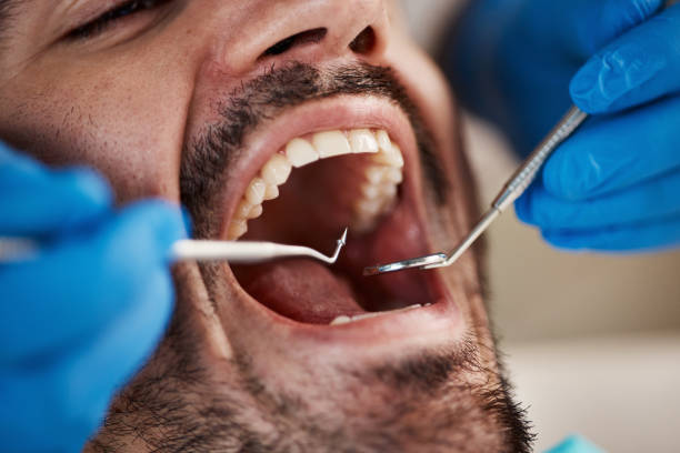 Best Broken or Cracked Tooth Emergency Dentist in Searles Valley, CA